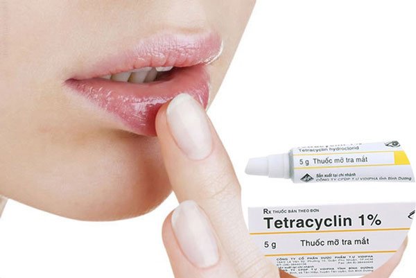 Có nên bôi thuốc mỡ Tetracyclin sau khi xăm môi