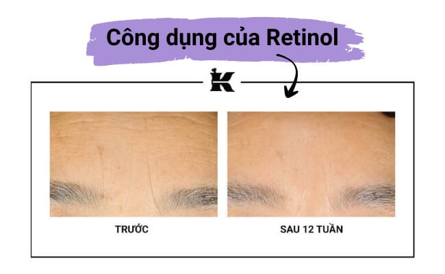 Công dụng của retinol đối với làn da 